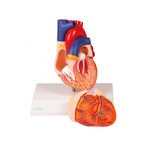 Heart Hypertrophy Model